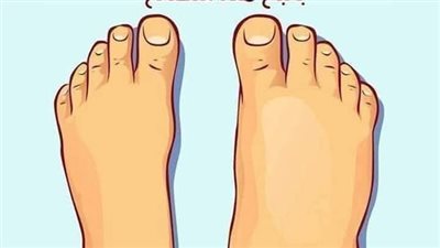كيف تتخلص من احتباس السوائل في الجسم